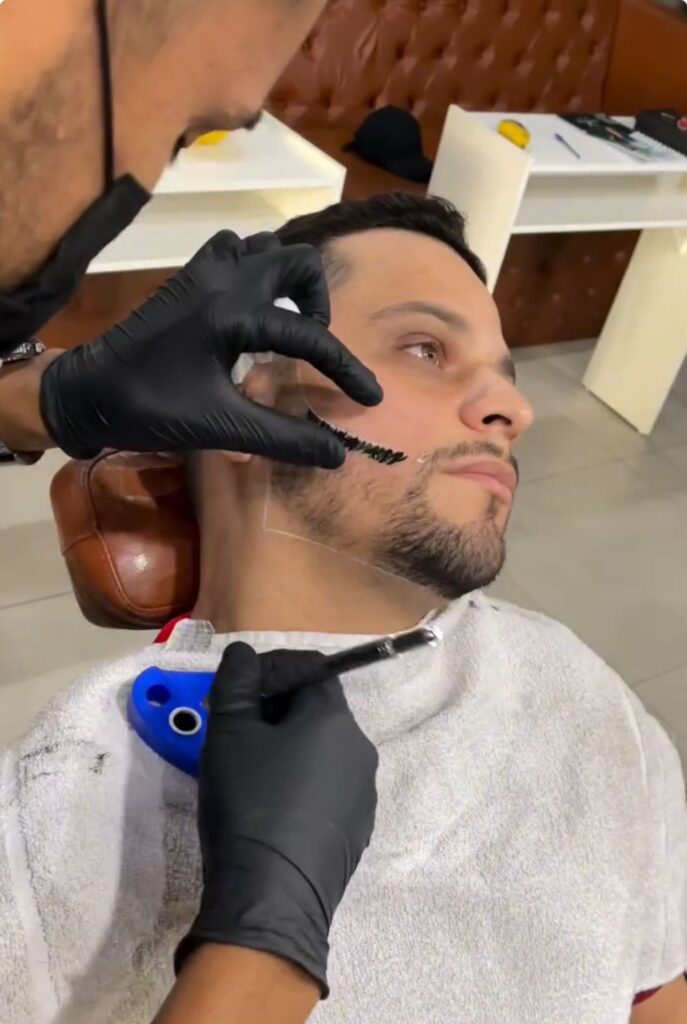 PREENCHIMENTO DE BARBA E PREENCHIMENTO CAPILAR - NANOBLANDING FIO A FIO